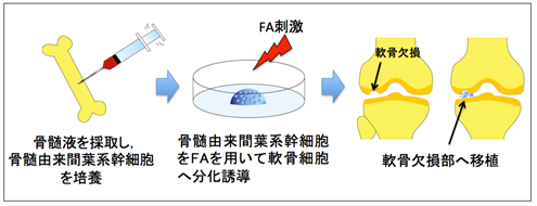 【再生医療】岡山大、関節軟骨の再生を誘導するステロイドホルモンを発見