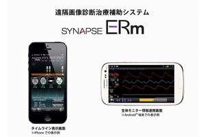 遠隔画像診断治療補助システム「SYNAPSE ERm（シナプス イーアールエム）」新発売（画像：富士フイルム）