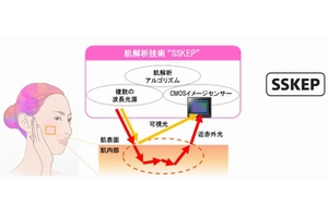 肌解析技術 “SSKEP”のイメージ図（画像：ソニー）