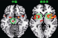 痒いところを掻いて快感が生じているときに報酬系と呼ばれる脳部位（中脳や線条体）が活動していることを示す写真（自然科学研究機構生理学研究所のプレスリリースより）