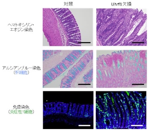 Uhrf1欠損マウスの大腸では、炎症細胞の浸潤と青色に染まる杯細胞（粘液産生細胞であり炎症により減少する）の消失が認められる（中段右）。また、Uhrf1欠損マウスでは炎色性の免疫細胞浸潤（緑色）が顕著に認められる（下段右）ことから、Uhrf1欠損マウスは大腸炎を発症していることが分かる。