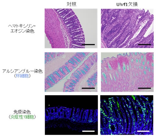 Uhrf1欠損マウスの大腸では、炎症細胞の浸潤と青色に染まる杯細胞（粘液産生細胞であり炎症により減少する）の消失が認められる（中段右）。また、Uhrf1欠損マウスでは炎色性の免疫細胞浸潤（緑色）が顕著に認められる（下段右）ことから、Uhrf1欠損マウスは大腸炎を発症していることが分かる。