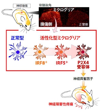 今回の研究で明らかにされた神経障害性疼痛の仕組を示す図（九州大学の発表資料より）