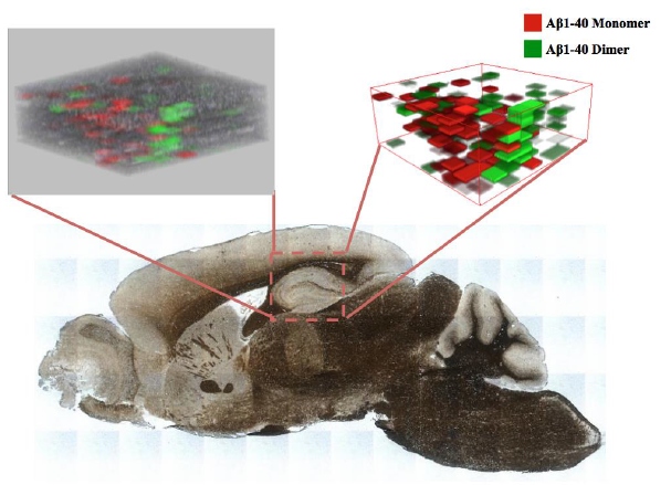 アルツハイマー病関連分子であるアミロイドβの脳内の3次元分布を示したもの（名古屋大学の発表資料より）