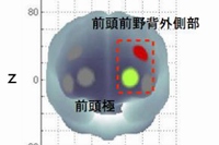 軽強度の運動によって活動が高まった脳の部位を示す図（筑波大学と中央大学の発表資料より）