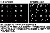 野生型IPS細胞とTERT欠損IPS細胞の染色体（九州大学の発表資料より）