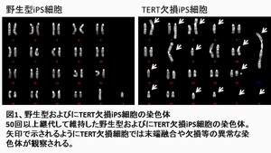 野生型IPS細胞とTERT欠損IPS細胞の染色体（九州大学の発表資料より）