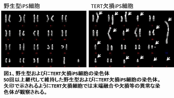 野生型IPS細胞とTERT欠損IPS細胞の染色体（九州大学の発表資料より）