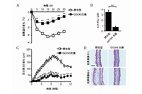 A：DOCK5欠損マウスでは、抗原プラスIgE抗体投与による直腸温の低下が軽度であり、アナフィラキシーショックに抵抗性を示す。B：DOCK5欠損マウスでは、抗原プラスIgE抗体投与による血中ヒスタミン値の上昇が認められない。C：マウス耳介への抗原塗布によるアレルギー反応でも、DOCK5欠損マウスは抵抗性を示す。D：アレルギー反応誘導後の耳介組織を示す。（九州大学の発表資料より）