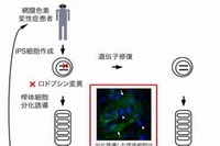 慶應義塾大学の小沢洋子講師らによる研究グループは、網膜色素変性症の患者からiPS細胞を作成し、そのメカニズムを解明することに成功した。