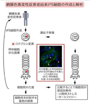 慶應義塾大学の小沢洋子講師らによる研究グループは、網膜色素変性症の患者からiPS細胞を作成し、そのメカニズムを解明することに成功した。