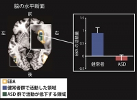 左図：真似をされていないときに比べて真似をされたときに強く活動した領域を示す図。健常群ではEBA(黄色枠)の一部が活動したが（脳断面の青色の部分）、ASD群では活動が低下していた（脳断面の緑色の部分）。右図：その領域の活動量を棒グラフで表したもの。青色の健常群と赤色のASD群で、EBA領域の活動量に差があることが分かった。（生理学研究所の発表資料より）