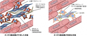 オメガ３脂肪酸の心臓リモデリング抑制作用のメカニズムを示す図（研究の発表資料より）