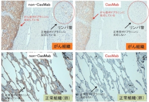 ポドプラニンに対するCasMab（がん特異的抗体）は、がん細胞のみを攻撃するため、正常細胞を攻撃することによって引き起こされる副作用がないことが期待される（東北大学の発表資料より）