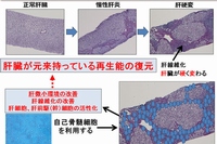 自己骨髄細胞を用いた肝臓再生療法の作用機序のイメージ（山口大学の発表資料より）