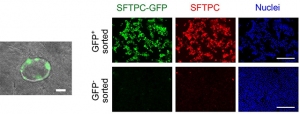 （左）II型肺胞上皮細胞に分化するとGFPが光るヒトiPS細胞を作成し、3次元培養で光ることを証明した。（右）GFP陽性細胞と陰性細胞をそれぞれ単離するとGFPとSFTPCが高い一致率であることがわかった（京都大学の発表資料より）