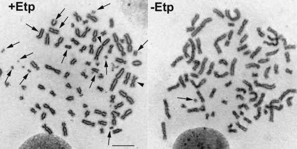 ヒト細胞の分裂期に抗がん剤（エトポシド）で、DNAに傷を入れるとゲノムDNAの破壊が起こる様子。左がDNAに傷を入れた場合、右はDNAの傷を入れない対照実験。ヒト染色体上で矢印が壊れている箇所（大阪大学の発表資料より）