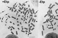 ヒト細胞の分裂期に抗がん剤（エトポシド）で、DNAに傷を入れるとゲノムDNAの破壊が起こる様子。左がDNAに傷を入れた場合、右はDNAの傷を入れない対照実験。ヒト染色体上で矢印が壊れている箇所（大阪大学の発表資料より）