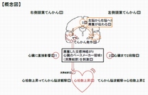 左右側頭葉からの発作活動が心臓に至る経路の概要を示す図（東北大学の発表資料より）