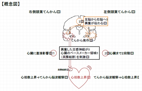 左右側頭葉からの発作活動が心臓に至る経路の概要を示す図（東北大学の発表資料より）