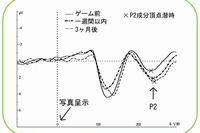 暴力的なテレビゲームで遊んだ成人に怒り顔の刺激を提示した場合に後頭部で観察された事象関連電位成分P2成分と分析対象電極の位置（東京大学の発表資料より）