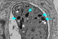 宿主の細胞の中に感染しているトキソプラズマの電子顕微鏡写真。矢印の「デンスグラニュール（濃縮顆粒）」からGRAタンパク質が宿主細胞質に分泌される（大阪大学の発表資料より）