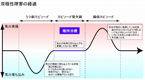 考慮事項