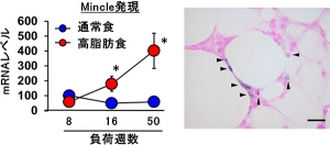 肥満の脂肪組織におけるMincleの発現上昇を示す図（東京医科歯科大学の発表資料より）