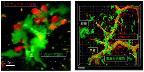 真皮樹状細胞とエフェクターT細胞の集簇（左）と、血管周囲に集簇する真皮樹状細胞とマクロファージ（右）（京都大学の発表資料より）