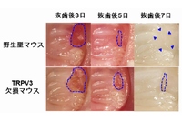 マウス口腔内の写真。TRPV3欠損マウスでは、青い線で囲まれた抜歯後の傷の面積が野生型マウスよりも広い（九州大学の発表資料より）