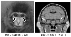 早老症モデルのサル（京都大学の発表資料より）