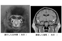 早老症モデルのサル（京都大学の発表資料より）