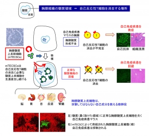 胸腺髄質上皮幹細胞の発見とその移植による自己免疫疾患の回避を示す図（京都大学の発表資料より）