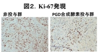 がん細胞の増殖活性の指標であるKi-67発現が、PGD合成酵素投与により低下している（大阪市立大学の発表資料より）