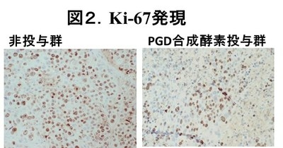 がん細胞の増殖活性の指標であるKi-67発現が、PGD合成酵素投与により低下している（大阪市立大学の発表資料より）