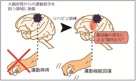 運動指令を担う領域の損傷後、把握動作を用いたリハビリにより手の運動機能が回復した。このとき残存する脳領域で損傷した領域の機能を肩代わりする脳活動の変化が生じていた（産総研の発表資料より）