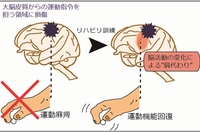 運動指令を担う領域の損傷後、把握動作を用いたリハビリにより手の運動機能が回復した。このとき残存する脳領域で損傷した領域の機能を肩代わりする脳活動の変化が生じていた（産総研の発表資料より）