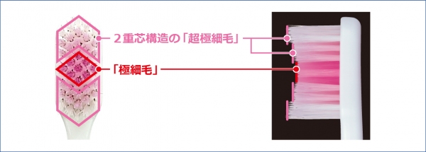 歯のすみずみの汚れを落としながら歯周ポケットもキレイにできるという「システマ アーチフィット ハブラシ」