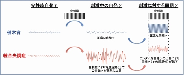 九州大学の研究グループは、統合失調症で知覚や認知機能を司るγ帯域皮質活動が、音刺激によって変化することを明らかにした（写真：九州大学の発表資料より）