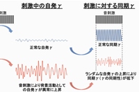 九州大学の研究グループは、統合失調症で知覚や認知機能を司るγ帯域皮質活動が、音刺激によって変化することを明らかにした（写真：九州大学の発表資料より）