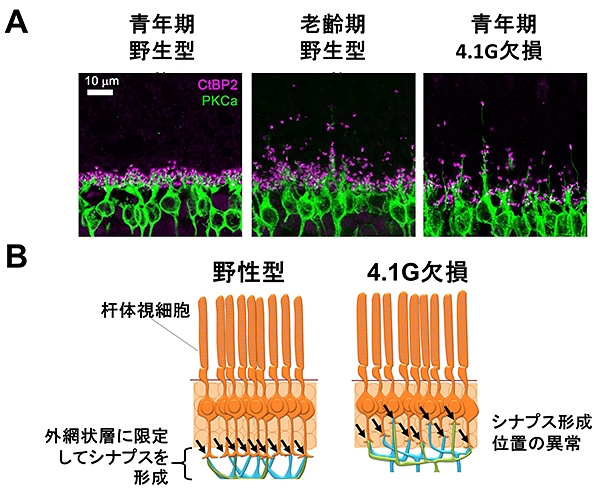 A.視細胞シナプス（赤紫）と双極細胞（緑）の染色像とB.シナプス形成位置異常の模式図（大阪大学の発表資料より）