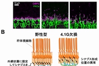 A.視細胞シナプス（赤紫）と双極細胞（緑）の染色像とB.シナプス形成位置異常の模式図（大阪大学の発表資料より）