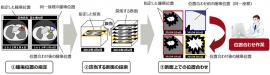 画像比較による腫瘍の経時変化の観察(富士通研究所の発表資料より)