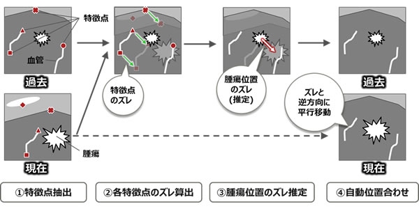 自動位置合わせの基本的な考え方(富士通研究所の発表資料より)