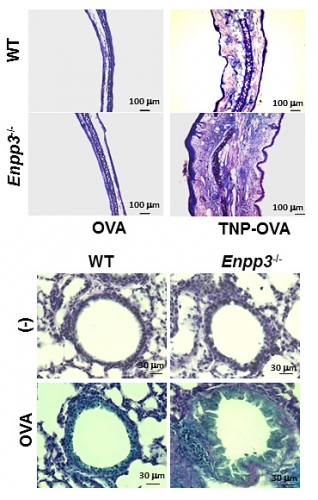 虫垂切除マウスの大腸と、小腸におけるIgA陽性細胞数を示す写真。（上段）正常マウス（WT）およびE-NPP3欠損マウス（Enpp3-/-）に抗TNP-IgEを静脈内投与し、1日後にアレルゲン（TNP-OVA）を右耳に塗布し、4日後にヘマトキシリン・エオジン染色により組織解析した。E-NPP3欠損マウスでは、皮膚アレルギーの増悪が認められた。（下段）正常マウス（WT）およびE-NPP3欠損マウス（Enpp3-/-）にアレルゲン（OVA/Alum）を2度腹腔内投与し、7日後から6度OVAを経鼻投与した。最終投与後に、肺をアルシアン・ブルーおよびヘマトキシリン染色により組織解析した。E-NPP3欠損マウスでは、粘液産生亢進とともに炎症細胞の間質への浸潤が顕著に認められた（大阪大学と科学技術振興機構の発表資料より）