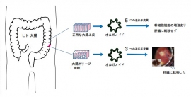 今回の研究では、ヒト大腸から採取した組織よりオルガノイドを作製し遺伝子変異を導入した後にマウスに移植を行った。正常な大腸上皮由来のオルガノイドは、5つの遺伝子変異が入ることにより幹細胞機能が高まったが、肝臓に転移しなかった。一方、腺腫から作製したオルガノイドは3つの遺伝子変異を加えることで、肝臓への転移が認められた(慶應義塾大学の発表資料より)