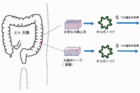 今回の研究では、ヒト大腸から採取した組織よりオルガノイドを作製し遺伝子変異を導入した後にマウスに移植を行った。正常な大腸上皮由来のオルガノイドは、5つの遺伝子変異が入ることにより幹細胞機能が高まったが、肝臓に転移しなかった。一方、腺腫から作製したオルガノイドは3つの遺伝子変異を加えることで、肝臓への転移が認められた(慶應義塾大学の発表資料より)