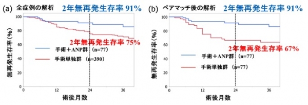 全症例の無再発生存率のグラフ（左図）と症例マッチングを行った無再発生存率のグラフ（右図）。いずれも本来は合併症予防の為に投与されたANP群（手術＋ANP群）が、手術単独群（対照群）と比較して術後2年無再発生存率が良好な成績だった（国立循環器病研究センターの発表資料より）