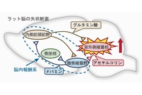 薬物依存に関わる神経回路の模式図。背外側被蓋核ニューロンの活動が可塑的に増強することによって最終的に腹側被蓋野ドパミン作動性ニューロンの活動が上昇することが依存形成に関与すると考えられる（北海道大学の発表資料より）