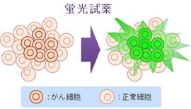 研究グループが開発した蛍光試薬を用いたがんの検出のイメージ。β－ガラクトシダーゼの活性が促進されているがん細胞で蛍光が観察され、がんの容易な識別が可能となる（東京大学などの発表資料より）